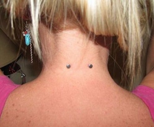 Micro Dermals Surface Nape Piercing Picture