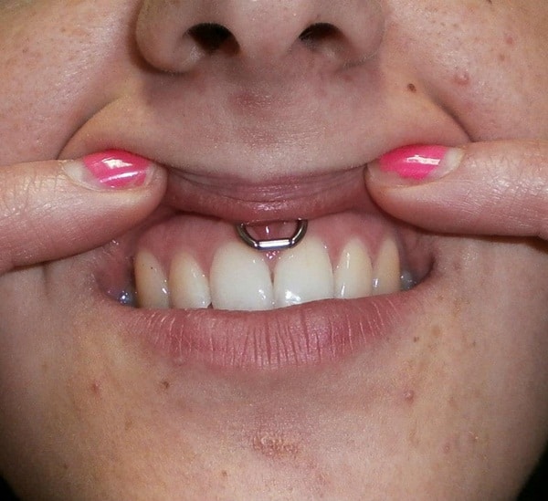 100 Smiley Piercing Ideas Jewelryfaqs Ultimate Guide 2020 