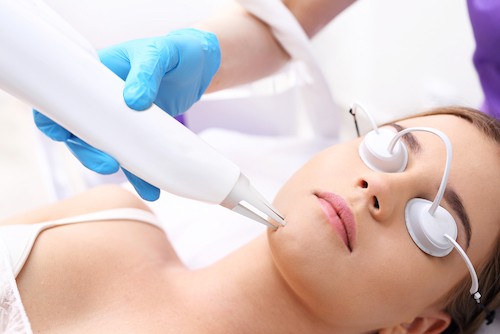 laser skin treatment